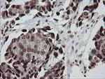 CHN1 Antibody in Immunohistochemistry (Paraffin) (IHC (P))