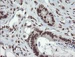 CHN1 Antibody in Immunohistochemistry (Paraffin) (IHC (P))