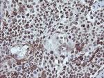 CHN1 Antibody in Immunohistochemistry (Paraffin) (IHC (P))