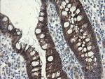 SLA2 Antibody in Immunohistochemistry (Paraffin) (IHC (P))