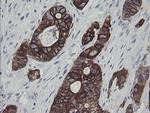 SLA2 Antibody in Immunohistochemistry (Paraffin) (IHC (P))