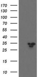 SLA2 Antibody in Western Blot (WB)