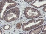 OTUB1 Antibody in Immunohistochemistry (Paraffin) (IHC (P))