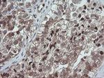 OTUB1 Antibody in Immunohistochemistry (Paraffin) (IHC (P))