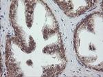 OTUB1 Antibody in Immunohistochemistry (Paraffin) (IHC (P))