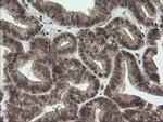 OTUB1 Antibody in Immunohistochemistry (Paraffin) (IHC (P))