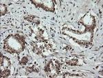 OTUB1 Antibody in Immunohistochemistry (Paraffin) (IHC (P))