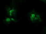 STK38L Antibody in Immunocytochemistry (ICC/IF)