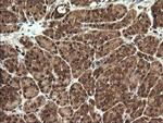 STK38L Antibody in Immunohistochemistry (Paraffin) (IHC (P))