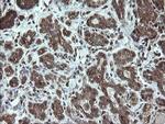 STK38L Antibody in Immunohistochemistry (Paraffin) (IHC (P))