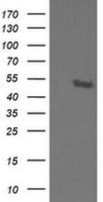 STK38L Antibody in Western Blot (WB)