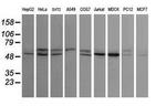 STK38L Antibody in Western Blot (WB)