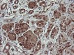 SDSL Antibody in Immunohistochemistry (Paraffin) (IHC (P))