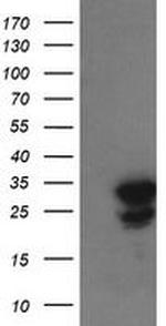 UBE2S Antibody in Western Blot (WB)