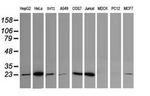 UBE2S Antibody in Western Blot (WB)