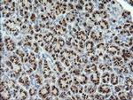 STK38L Antibody in Immunohistochemistry (Paraffin) (IHC (P))