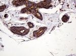 ATP6V1B2 Antibody in Immunohistochemistry (Paraffin) (IHC (P))