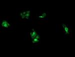 UBE2G2 Antibody in Immunocytochemistry (ICC/IF)