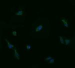 UBE2G2 Antibody in Immunocytochemistry (ICC/IF)