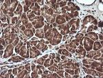 UBE2G2 Antibody in Immunohistochemistry (Paraffin) (IHC (P))