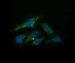 UBE2G2 Antibody in Immunocytochemistry (ICC/IF)