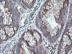 UBE2G2 Antibody in Immunohistochemistry (Paraffin) (IHC (P))