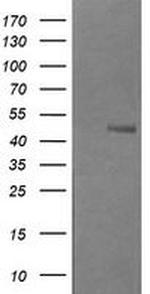 B3GNT2 Antibody in Western Blot (WB)