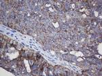 MRPL11 Antibody in Immunohistochemistry (Paraffin) (IHC (P))