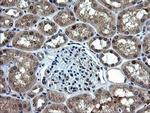 RAB37 Antibody in Immunohistochemistry (Paraffin) (IHC (P))