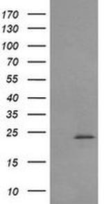 RAB30 Antibody in Western Blot (WB)