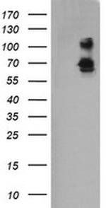 DEF6 Antibody in Western Blot (WB)