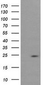 RAB37 Antibody in Western Blot (WB)