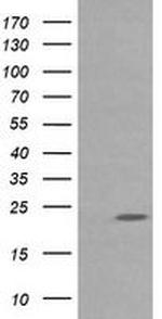 RAB30 Antibody in Western Blot (WB)