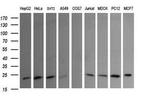 RAB30 Antibody in Western Blot (WB)