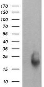 RAB30 Antibody in Western Blot (WB)