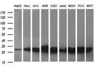 RAB30 Antibody in Western Blot (WB)