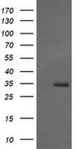 MAGEA4 Antibody in Western Blot (WB)