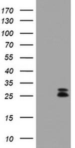 CMPK1 Antibody in Western Blot (WB)