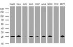 CMPK1 Antibody in Western Blot (WB)