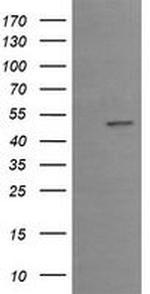 EGR2 Antibody in Western Blot (WB)