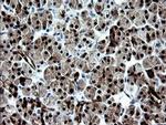 CMPK1 Antibody in Immunohistochemistry (Paraffin) (IHC (P))