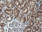 CMPK1 Antibody in Immunohistochemistry (Paraffin) (IHC (P))