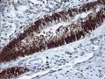 CMPK1 Antibody in Immunohistochemistry (Paraffin) (IHC (P))