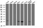 CMPK1 Antibody in Western Blot (WB)