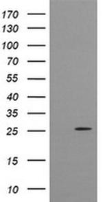 CMPK1 Antibody in Western Blot (WB)