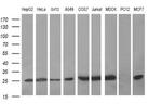 CMPK1 Antibody in Western Blot (WB)