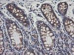 PTGES2 Antibody in Immunohistochemistry (Paraffin) (IHC (P))