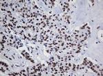 DCPS Antibody in Immunohistochemistry (Paraffin) (IHC (P))