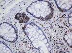 DCPS Antibody in Immunohistochemistry (Paraffin) (IHC (P))