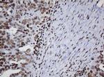 DCPS Antibody in Immunohistochemistry (Paraffin) (IHC (P))